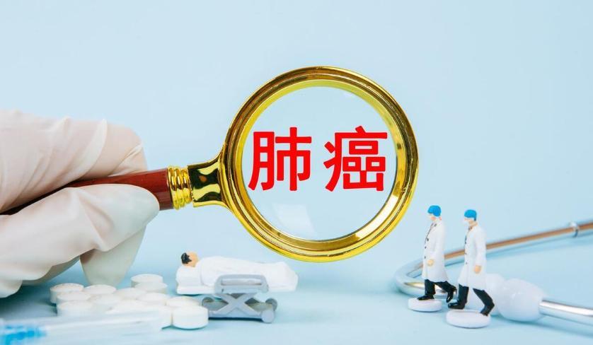 肺癌早筛深度解读:63%患者无咳嗽——五大非典型信号的识别与应对 健康养生