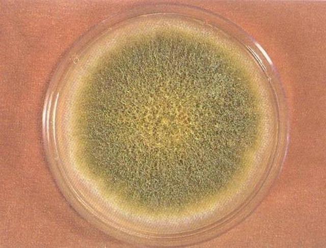  香蕉软化生理机制与安全边界：一份基于植物学与食品安全学的系统性指南 健康养生